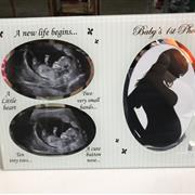 Baby scan picture frame